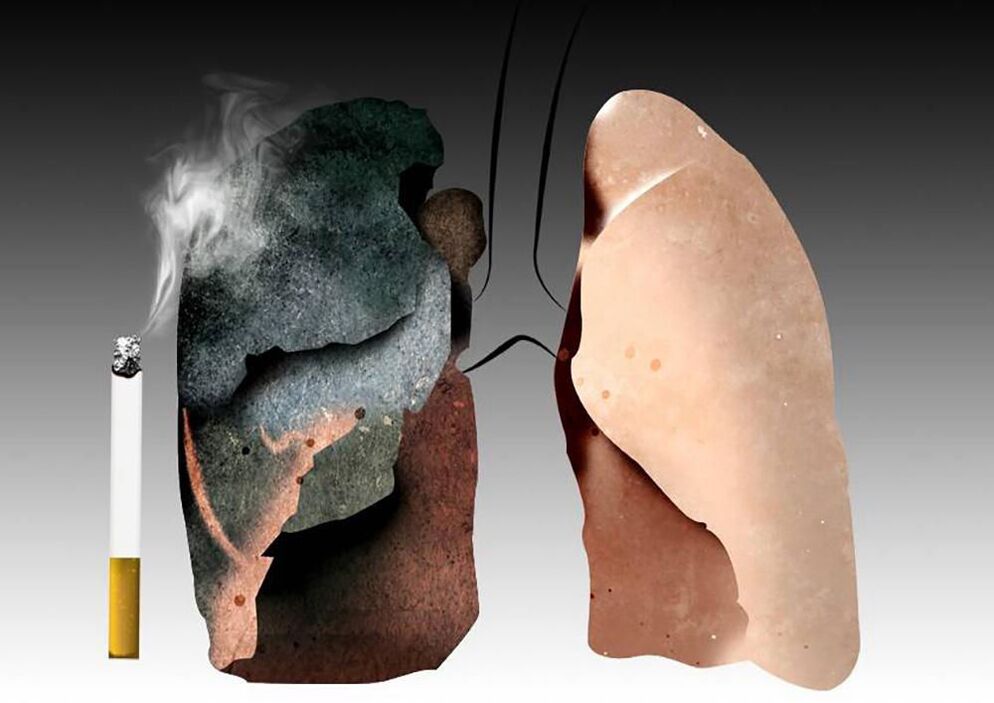 pulmões de um fumante